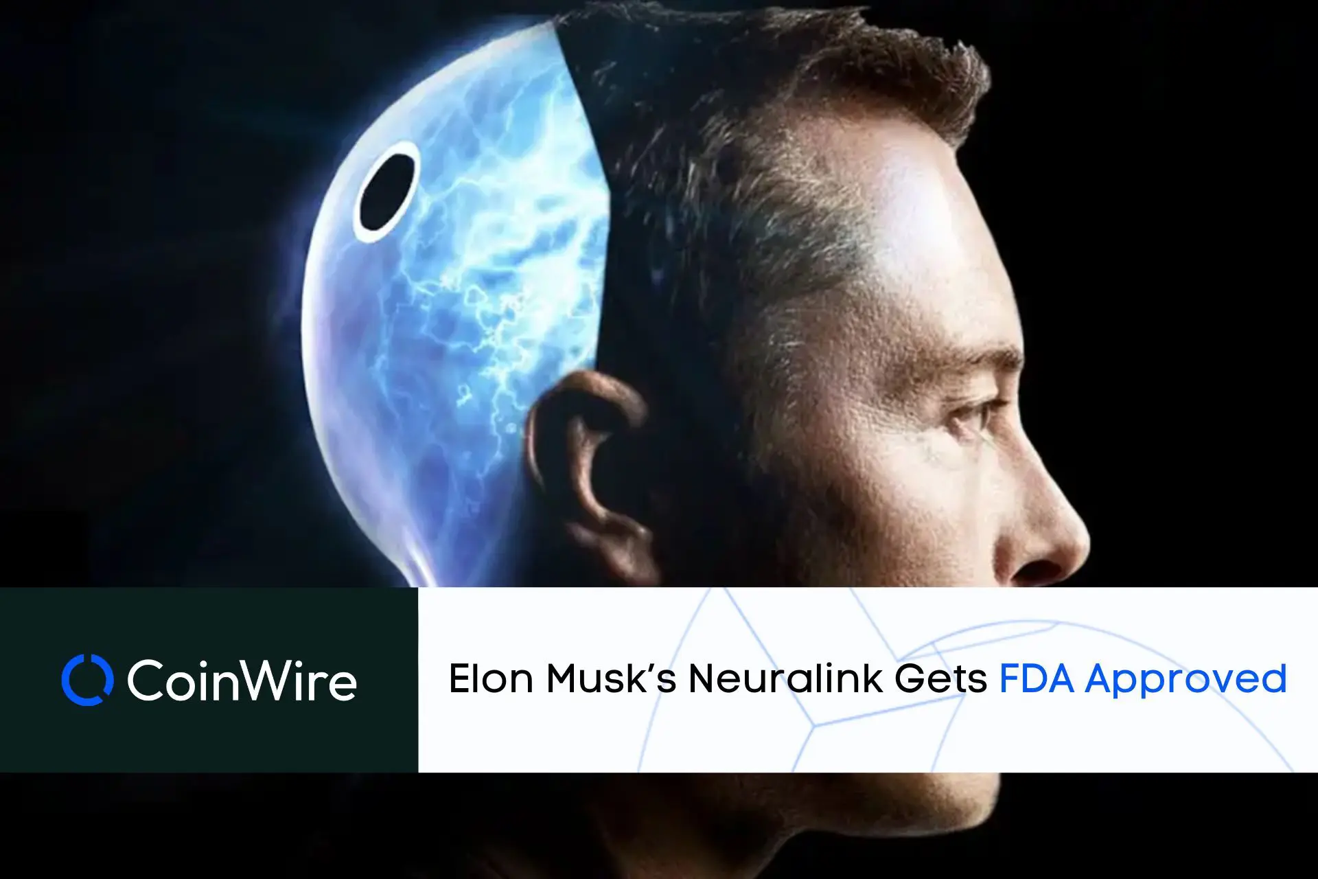 Elon Musk's Neuralink gets FDA approval for in-human study